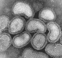Virusul gripal, imagine electrono-microscopica